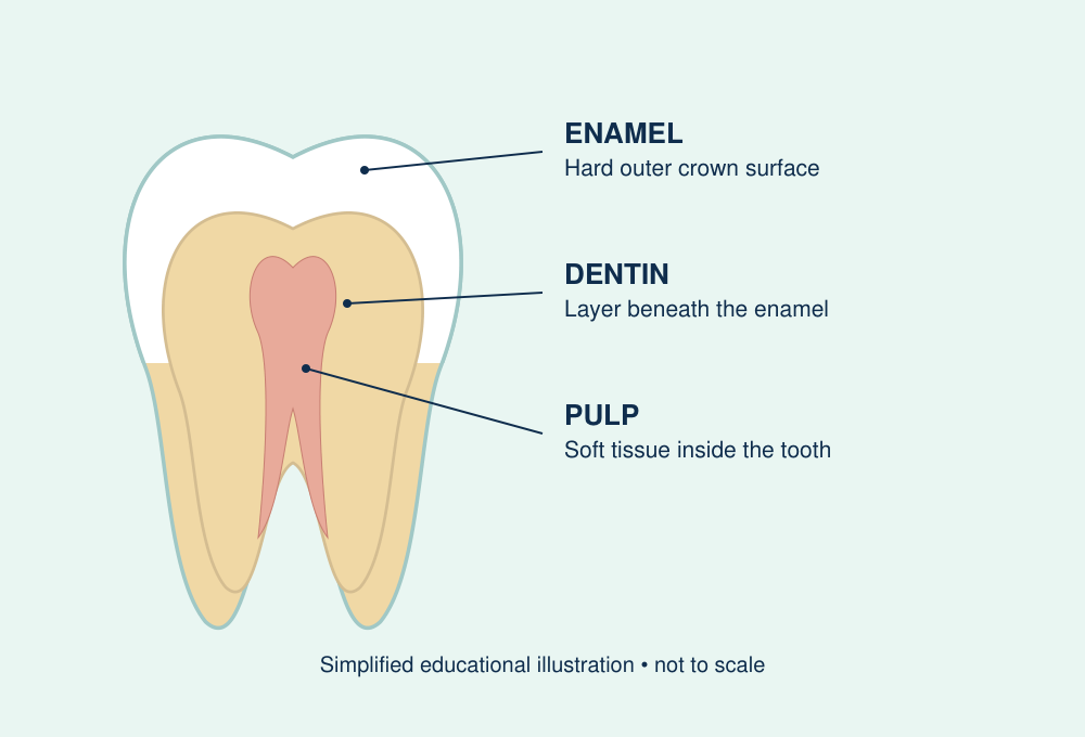Simplified tooth illustration showing enamel, dentin and pulp